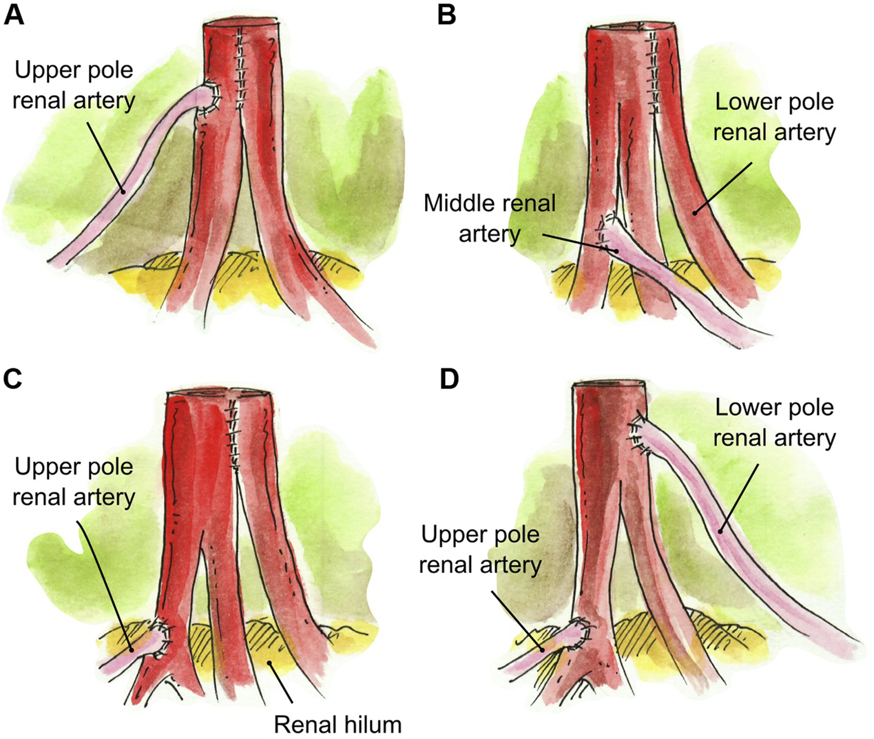 FIGURE 3