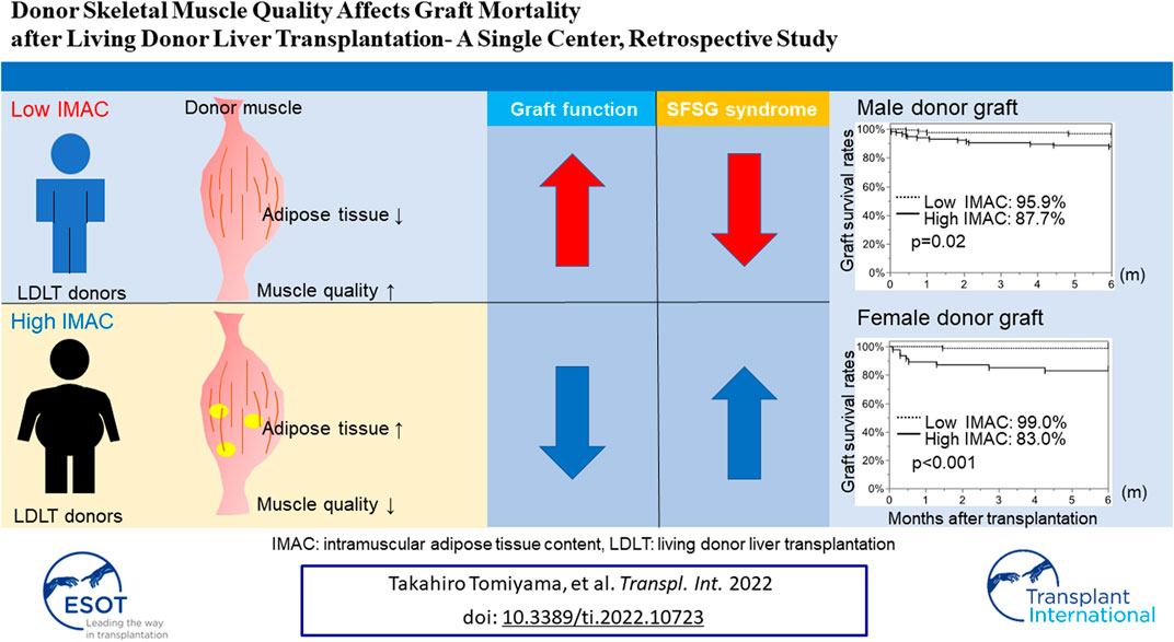 Impact of Sarcopenia on Outcomes Following Resection of Pancreatic Adenocarcinoma