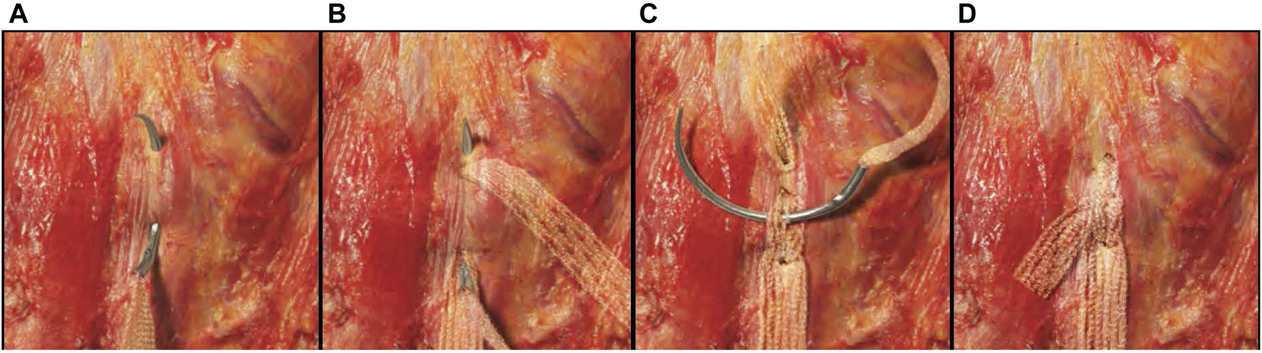 FIGURE 4