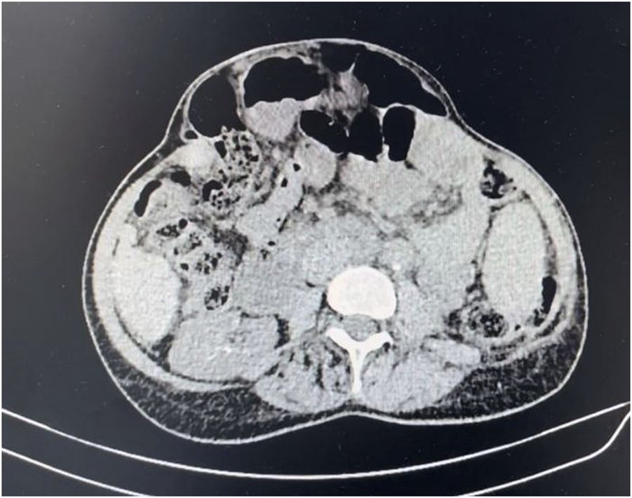 FIGURE 1