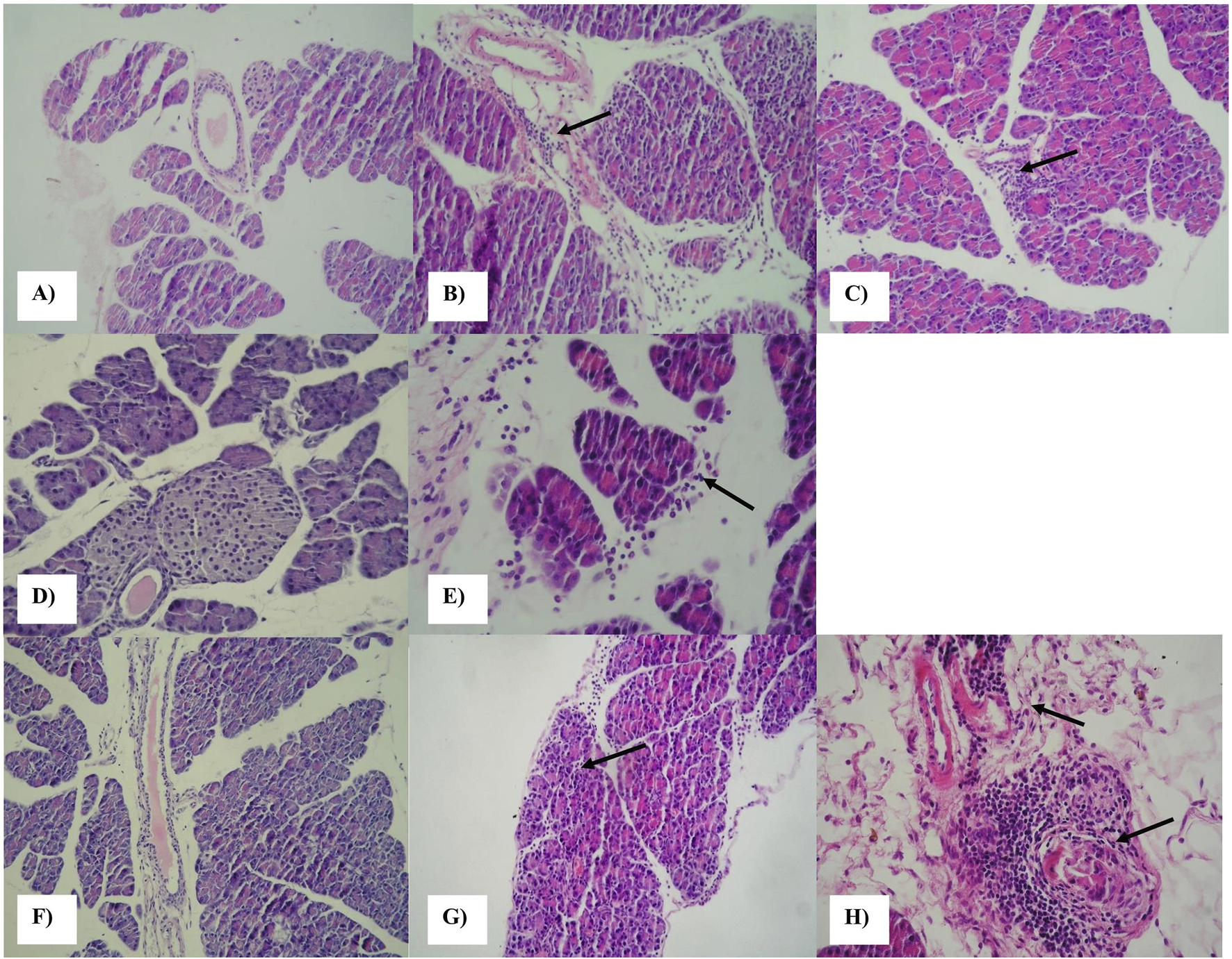 Histological images showing various tissue samples stained with hematoxylin and eosin. Each sample is labeled from A to H. Arrows in panels B, C, E, G, and H indicate specific areas of interest, possibly highlighting features such as cell structures or tissue abnormalities. The coloration and texture vary, emphasizing different tissue characteristics and cellular details.