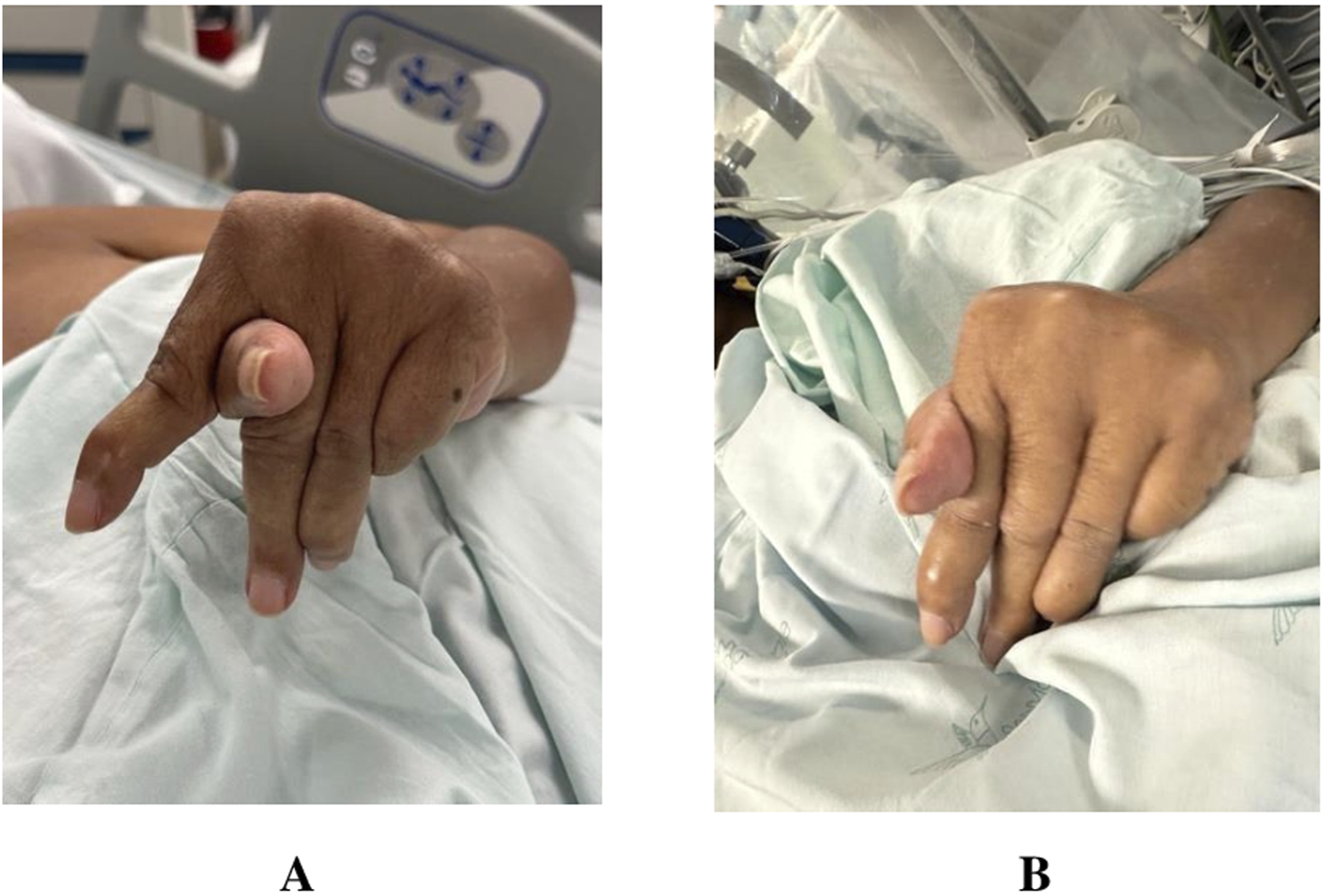 FIGURE 1