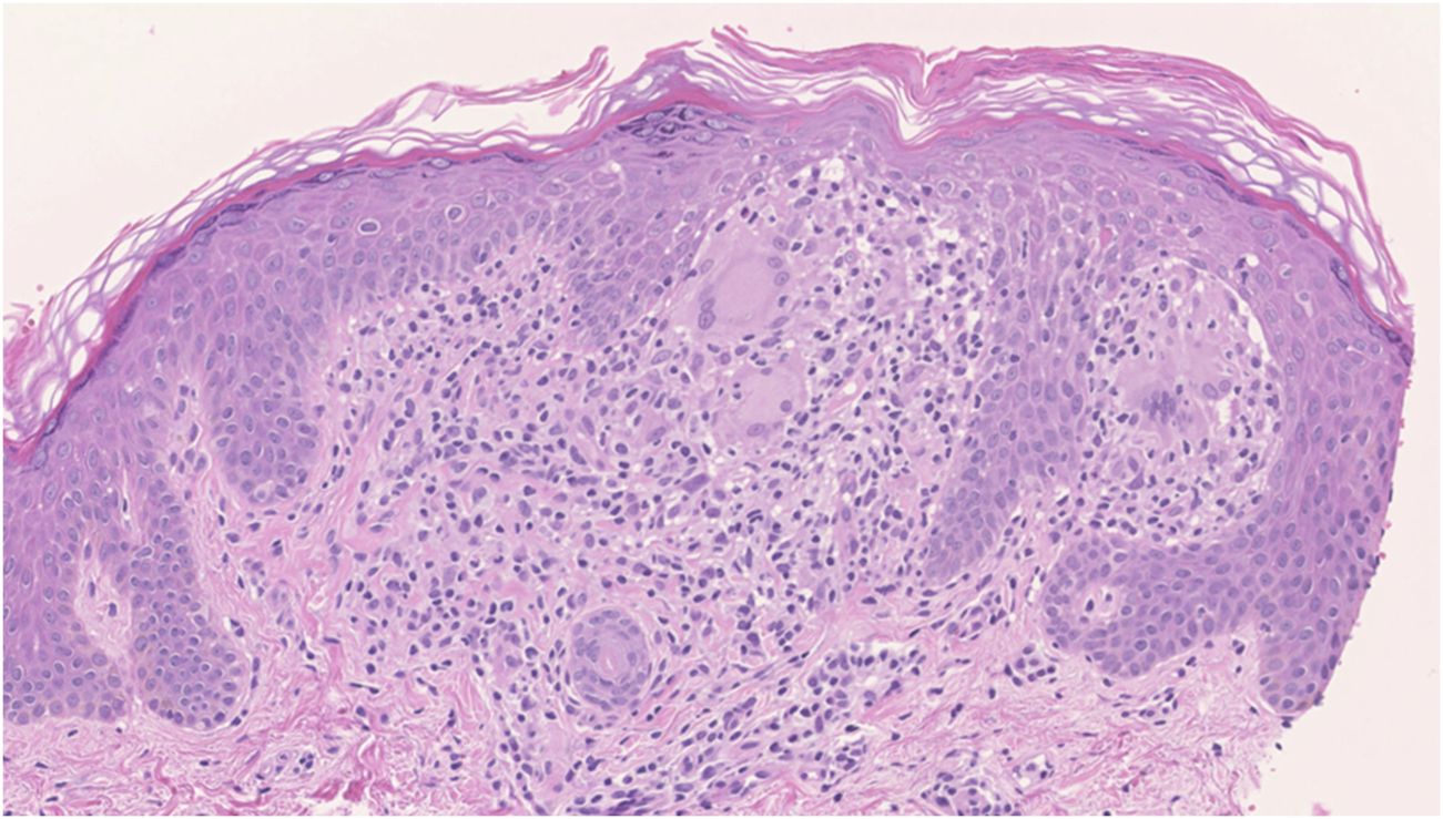 FIGURE 2