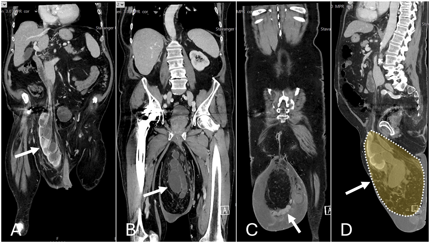 FIGURE 2
