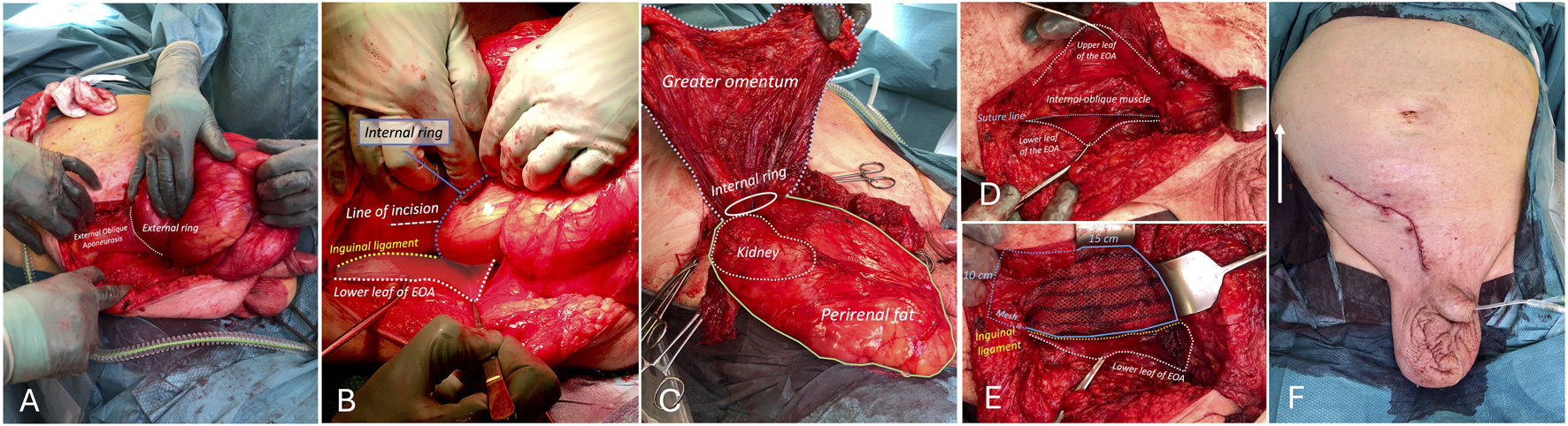 FIGURE 3
