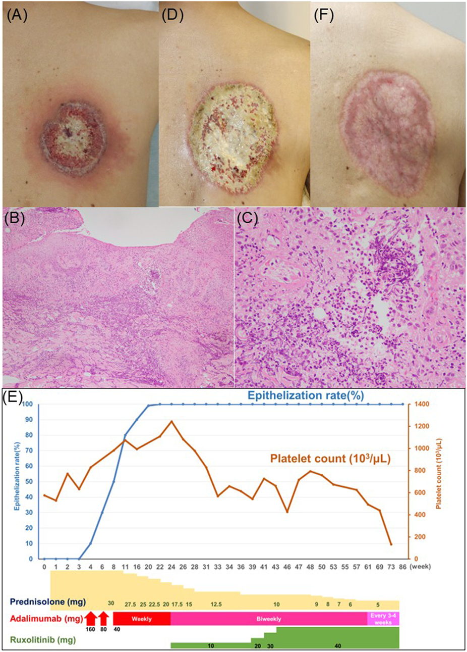 FIGURE 1