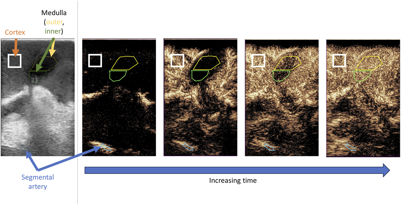 FIGURE 1