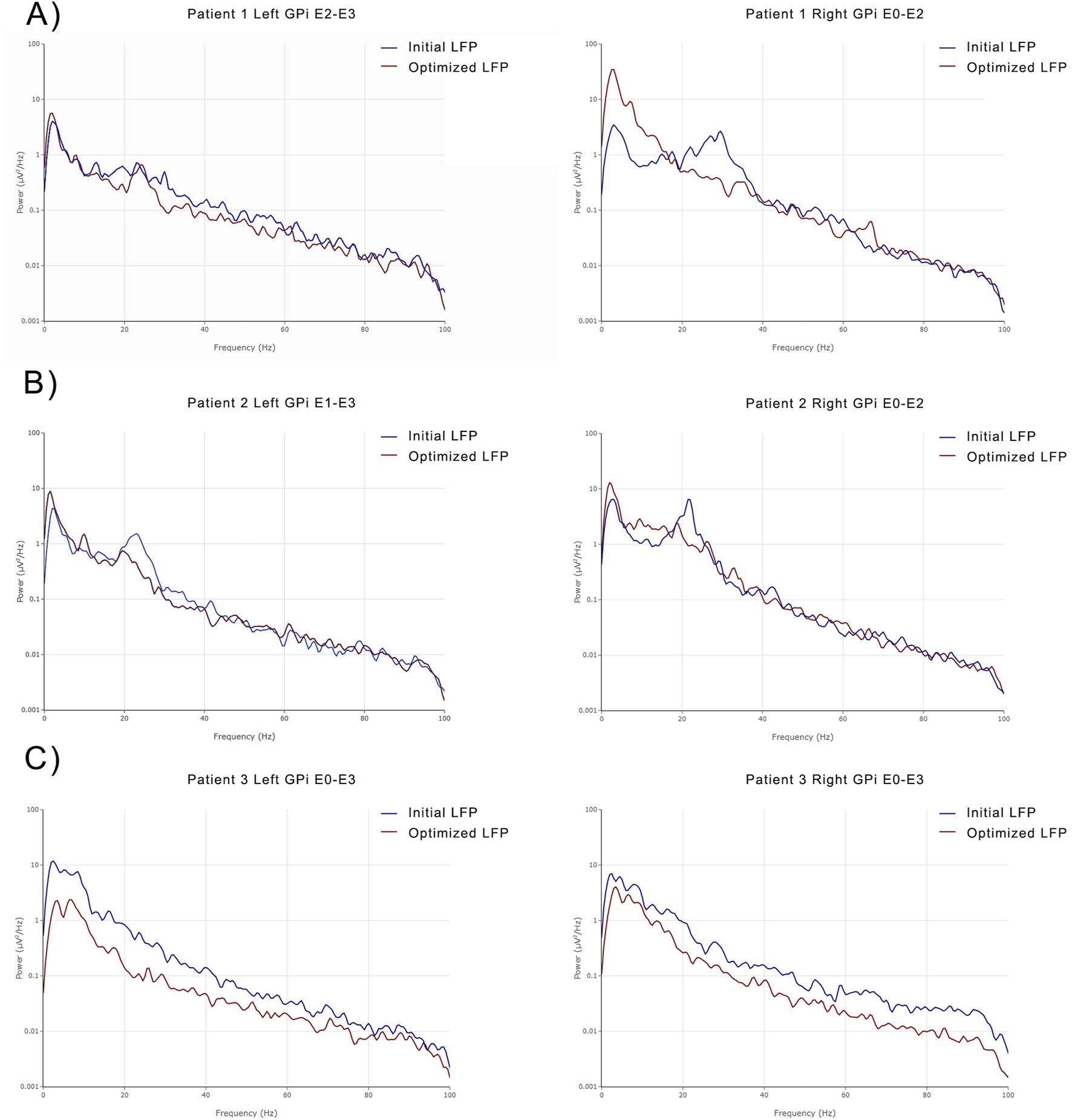 Graphs compare initial and optimized local field potentials (LFP) in patients. A) Patient 1: Left GPi E2-E3 and Right GPi E0-E2. B) Patient 2: Left GPi E1-E3 and Right GPi E0-E2. C) Patient 3: Left GPi E0-E3 and Right GPi E0-E3. X-axis is frequency (Hz), Y-axis is power (µV²/Hz). Blue lines represent initial LFP; red lines represent optimized LFP.