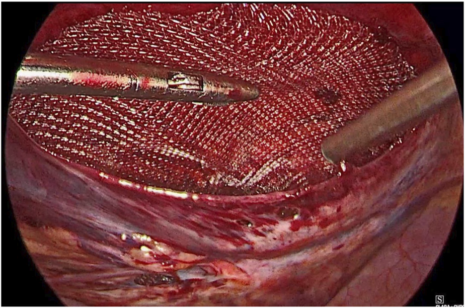 FIGURE 4