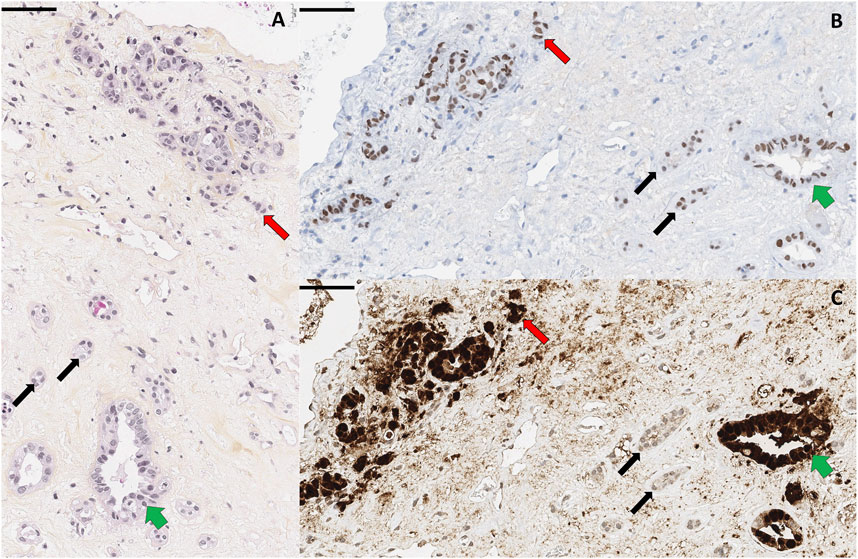 Histological images labeled A, B, and C show tissue with arrows. Red arrows point to certain cell clusters, black arrows indicate specific structures, and green arrows highlight different areas. Each image differs in staining intensity, revealing varied cellular features.