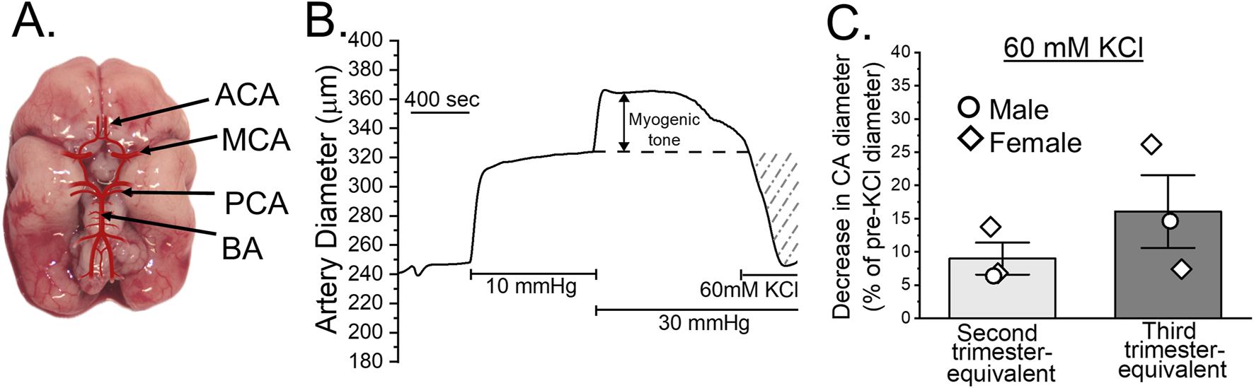 Diagram featuring three panels related to arterial study. Panel A shows a brain with labeled arteries: anterior cerebral artery (ACA), middle cerebral artery (MCA), posterior cerebral artery (PCA), and basilar artery (BA). Panel B graph presents artery diameter changes over time, indicating myogenic tone and effects of 60 mM KCl. Panel C bar chart illustrates decreases in artery diameter as a percentage of pre-KCl diameter, comparing male and female data during second and third trimester equivalents.
