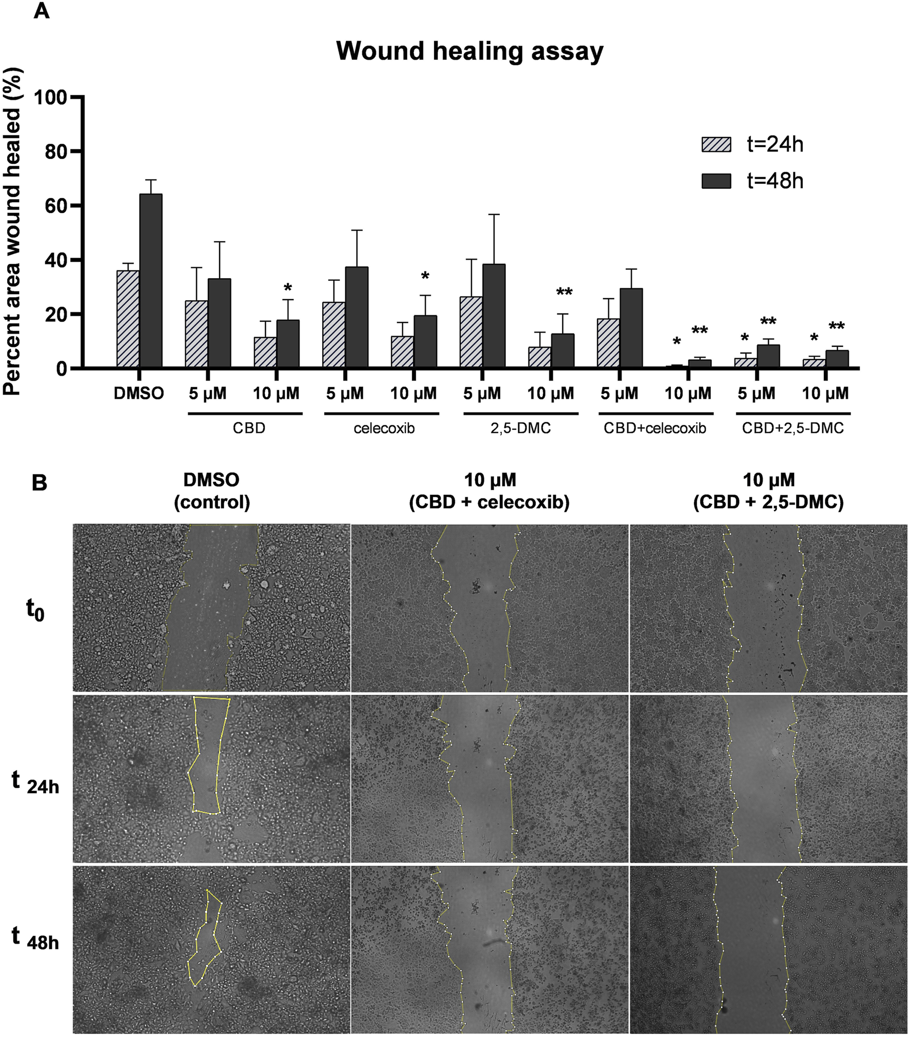 Graph A shows a bar chart illustrating the percent area of a wound healed after 24 and 48 hours under different treatments: DMSO, CBD, celecoxib, 2,5-DMC, and their combinations. Higher healing is observed at 48 hours, particularly with DMSO and 10 µM concentrations. Graph B displays microscopic images of wound healing at time points 0, 24, and 48 hours for DMSO, 10 µM CBD with celecoxib, and 10 µM CBD with 2,5-DMC, showing progressive wound closure over time.