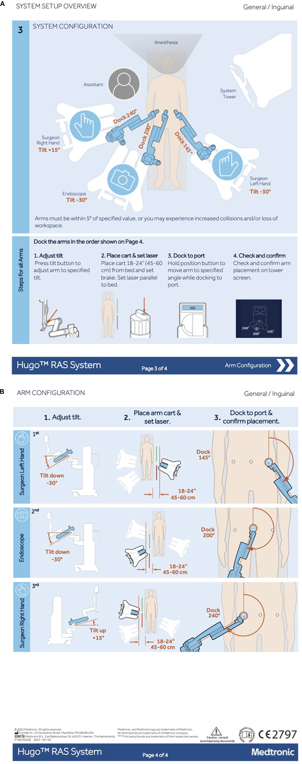 System configuration diagram for Hugo™ RAS System, displaying arm docking for surgery. Shows arm tilt and docking degrees for surgeon's hands and endoscope. Includes four steps: adjust tilt, place cart and set laser, dock to port, and check and confirm arm placement. An anesthesia section is noted alongside an assistant and system tower. Surgical diagram illustrating the arm configuration for the Hugo RAS System. It shows steps for adjusting tilt, placing the arm cart, and docking to a port. Three sections highlight configurations for the surgeon's left hand, endoscope, and right hand, including tilt angles and docking distances.