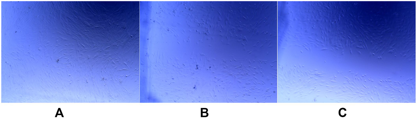 Three microscopic images labeled A, B, and C show blue-stained cell cultures. Image A has a higher density of elongated cells, while images B and C show progressively fewer cells. The cells appear scattered and vary slightly in shape and arrangement across the images.