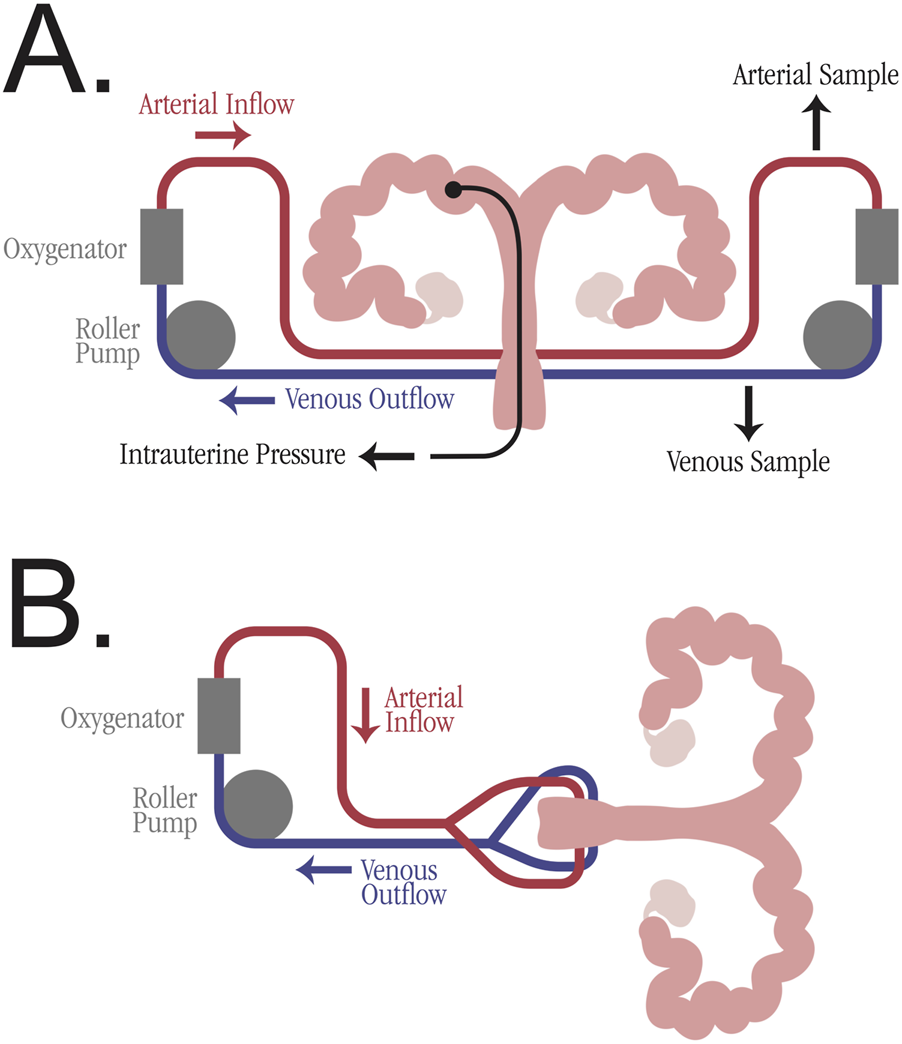 Diagram showing two fetal blood flow systems. Panel A: Circuit with oxygenator, roller pump, and intrauterine pressure measurement, featuring arterial inflow and venous outflow. Panel B: Simpler circuit with oxygenator and roller pump, illustrating arterial inflow and venous outflow connected to fetal organs.