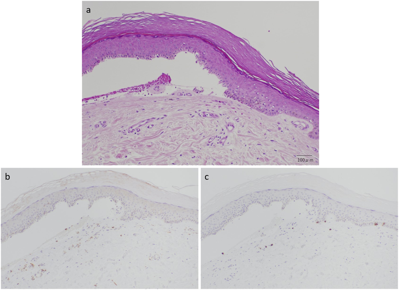 Histological images of skin tissue. Panel a shows a section stained with hematoxylin and eosin, highlighting layers and cellular details in pink and purple hues. Panels b and c display sections with different immunohistochemical stains, with reduced color intensity and highlighting specific cellular components. Scale bar in panel a indicates 100 micrometers.
