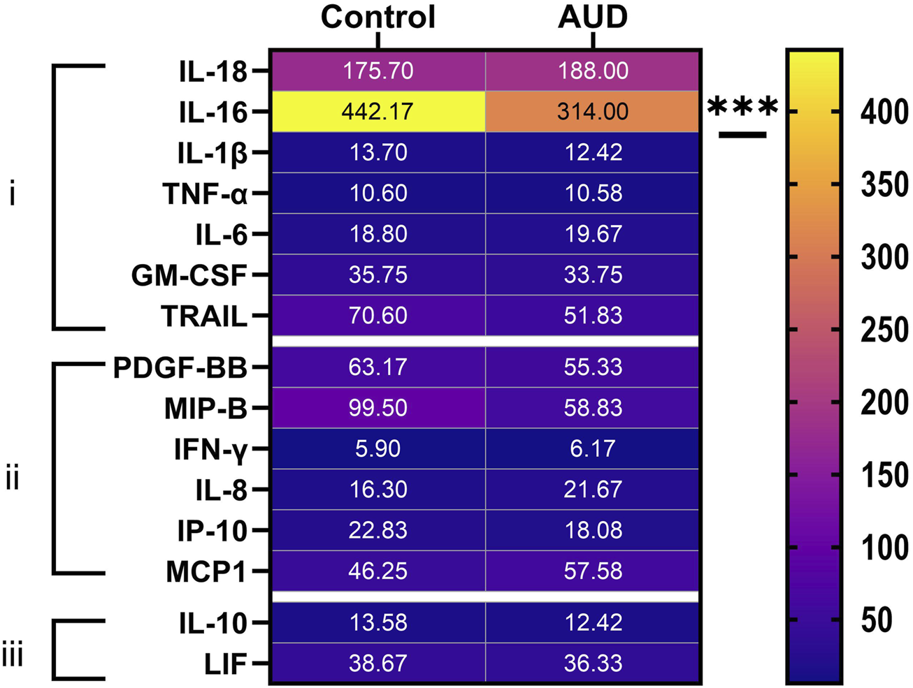 This heatmap illustrates very limited effects of AUD on inflammation in the brain. The cytokines were clustered into 3 groups: (i) proinflammatory cytokines, (ii) proinflammatory chemokines, and (iii) anti-inflammatory cytokines. expression in human control and AUD cerebellar tissue. The only difference detected was for IL-16, which was reduced by AUD. Therefore, the effects of chronic alcohol abuse on white matter were not attributable to inflammation in the brain.