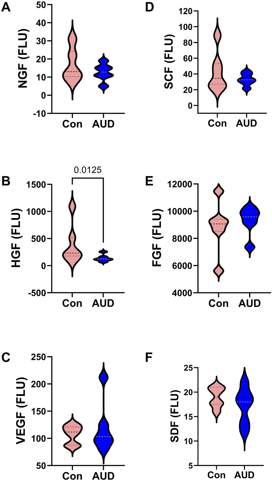 Analysis of AUD's effects on growth factor proteins in the brain. The levels of different growth factors were compared using an ELISA approach. AUD was associated with strikingly reduced cerebellar levels of hepatocyte growth factor (HGF). This finding is important because reduced HGF impairs neuronal survival and myelin integrity (thickness), which is needed for transmitting signals in the brain. Therefore, reduced HGF corresponds with brain degeneration and compromised functions in AUD.