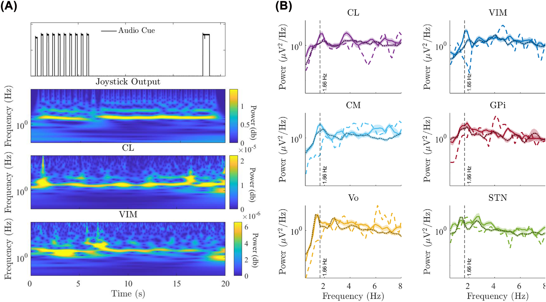 (A) Spectrograms show frequency changes over time for joystick output, CL, and VIM channels. (B) Line graphs for CL, CM, Vo, VIM, GPi, and STN illustrate power versus frequency, highlighting peaks around 1.66 Hz. Graphs reveal differences in neural signals across regions.
