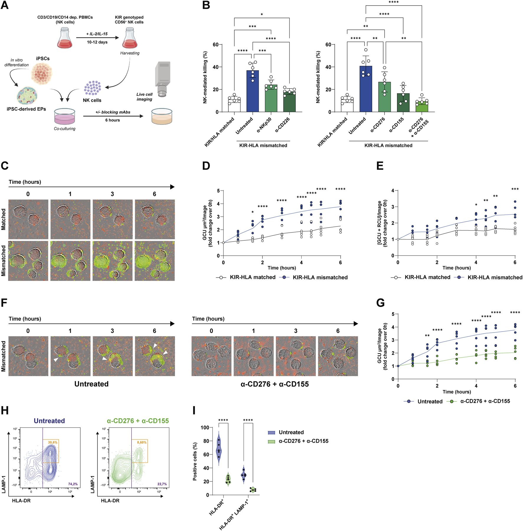 Panel A shows a schematic of the co-culture assay: KIR-genotyped NK cells, expanded from donor PBMCs, are incubated with iPSC-derived endocrine progenitor (EP) clusters in the presence or absence of blocking antibodies. Panel B presents bar graphs quantifying NK-mediated killing under KIR-HLA matched (white) or mismatched (colored) conditions, with blockade significantly reducing lysis. Panel C displays time-lapse images of EP clusters co-cultured with matched or mismatched NK cells. Panels D and E show kinetic analyses of cell death and NK-target co-localization, both reduced under matched conditions. Panel F shows images of NK infiltration with or without CD276 and CD155 blockade. Panels G and I show flow cytometry plots and violin plots quantifying NK activation (HLA-DR⁺), and degranulation (LAMP-1⁺) markers with or without antibodies.
