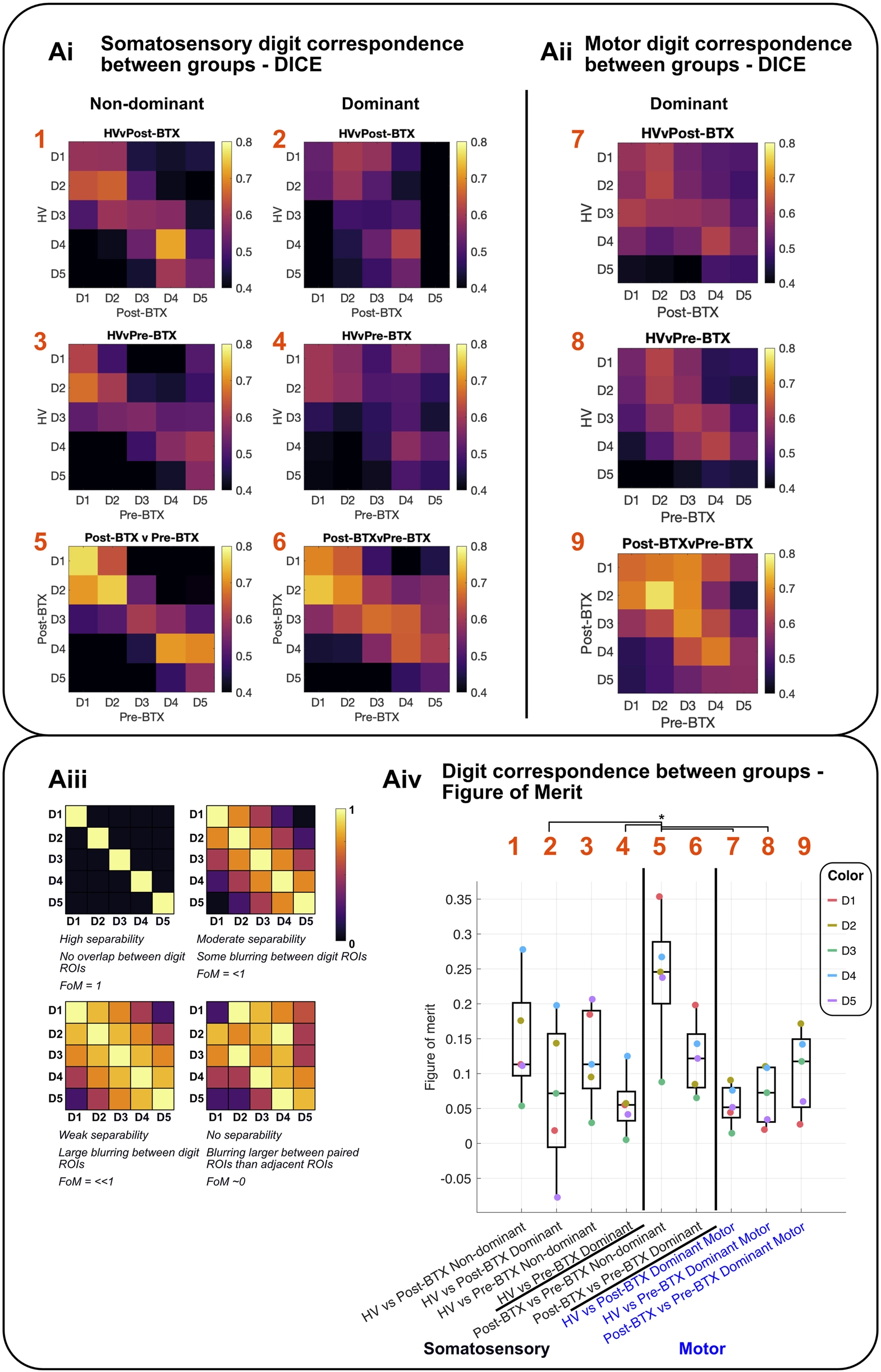 Figure composed of multiple panels displaying heatmaps, illustrations, and a boxplot analyzing digit correspondence using DICE coefficients and figures of merit. Panels Ai and Aii show nine heatmaps colored from dark purple to yellow, indicating somatosensory and motor digit correspondence across groups and hands, with axes labeled D1-D5. Panel Aiii presents four example heatmaps demonstrating separability levels with corresponding figure of merit scores. Panel Aiv features a boxplot comparing figure of merit values for groups, digits, and modalities, with statistical significance indicated by an asterisk, and axes labeled for conditions and digit colors.