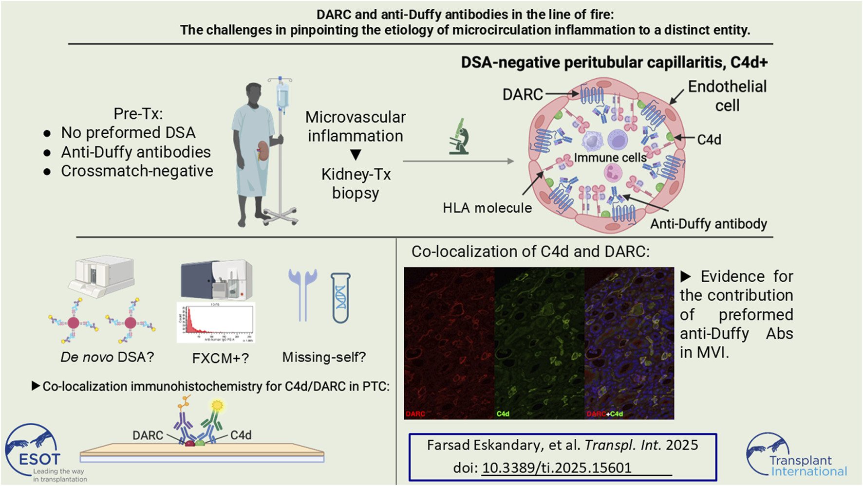 Illustration detailing the role of DARC and anti-Duffy antibodies in microvascular inflammation related to kidney transplants. It includes a diagram of DSA-negative peritubular capillaritis, patient pre-treatment status, and a kidney biopsy procedure. A section shows co-localization of C4d and DARC using immunohistochemistry, with evidence supporting the contribution of preformed anti-Duffy antibodies in microvascular injury (MVI).