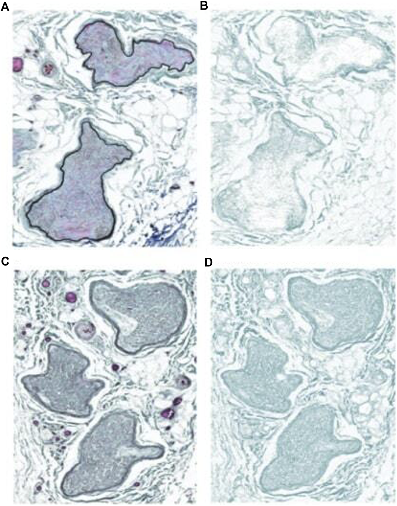 Histological images of tissue sections are labeled A through D. A and C show stained areas with black outlines, highlighting specific structures. B and D lack these outlines, with lighter staining. Variations in staining intensity and pattern are evident between the pairs, likely illustrating different conditions or treatments.